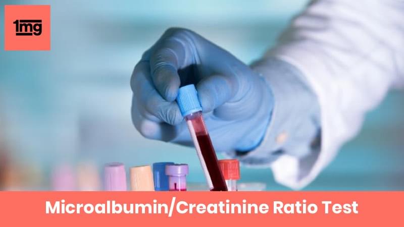 Microalbumin/Creatinine Ratio