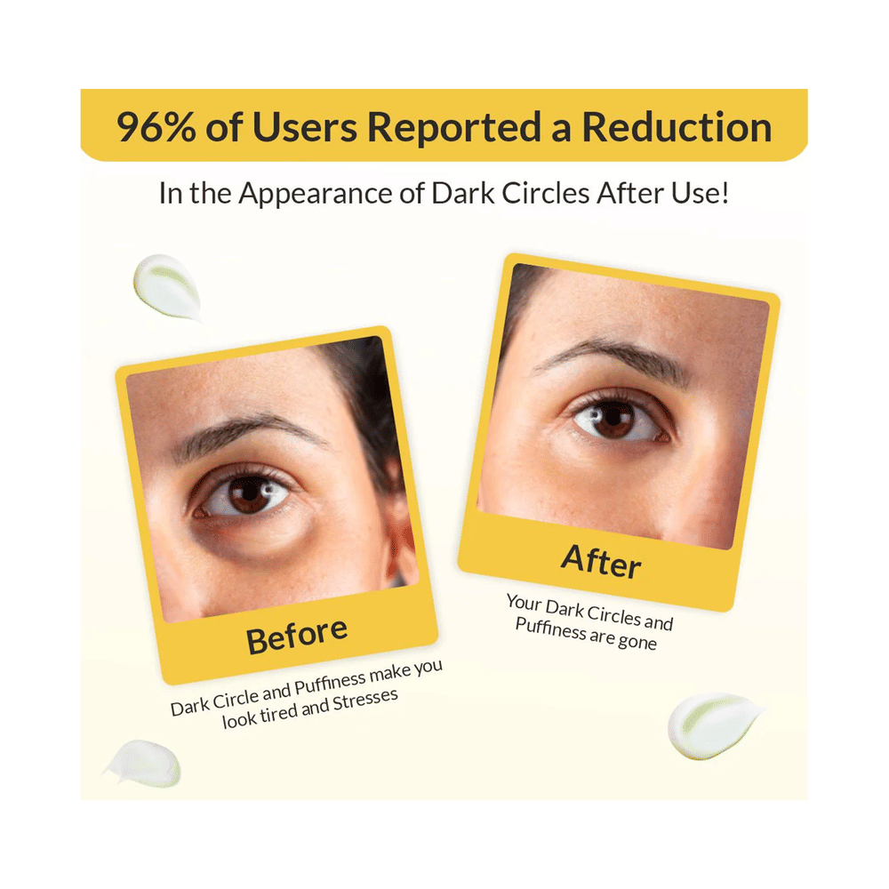 Eyecirque Under Eye Gel (30 gm Each)