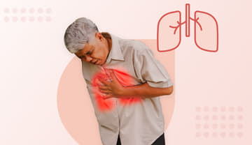 Lung cancer Lung cancer