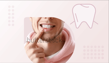 Gingivitis Gingivitis