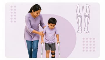 Rett Syndrome Rett Syndrome