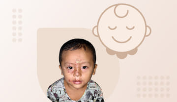 Impetigo Impetigo