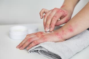 Bacterial skin infections