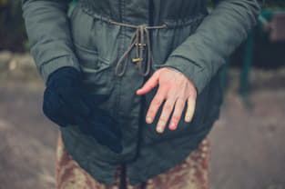 Raynaud's disease