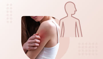 Bacterial skin infections Bacterial skin infections