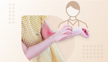 Zika virus disease Zika virus disease