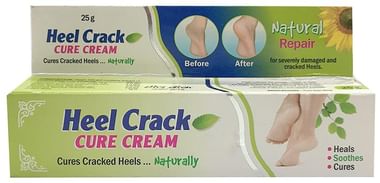 Alloes Foot Tos Cracked Heel Cream 50gm Each Buy combo pack of 2.0 jar at best price in India 1mg