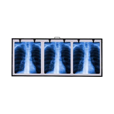 Fidelis X'ray View Box 18inch x 28inch Black Triple