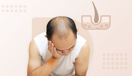 Hair loss