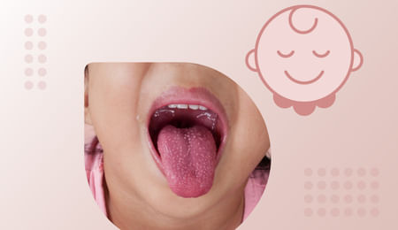Kawasaki Disease