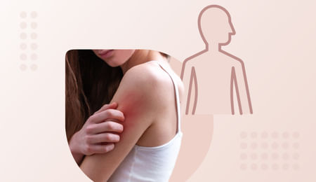 Bacterial skin infections Bacterial skin infections