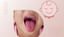 Kawasaki Disease