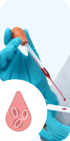 CBC (Complete Blood Count)