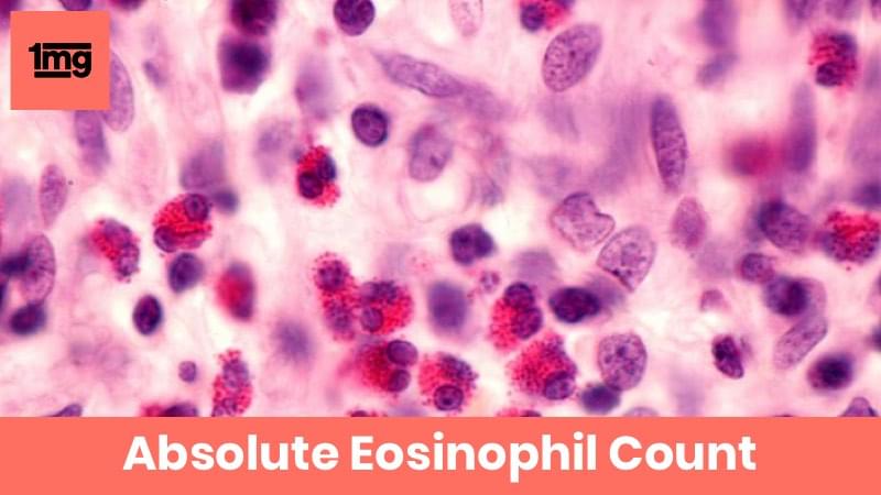 Absolute Eosinophil Count