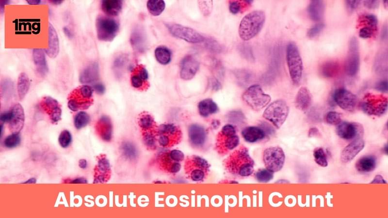 absolute-eosinophil-count-aec-purpose-normal-range-of-results-1mg