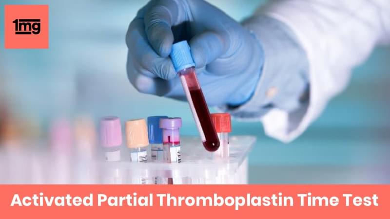 Activated Partial Thromboplastin Time