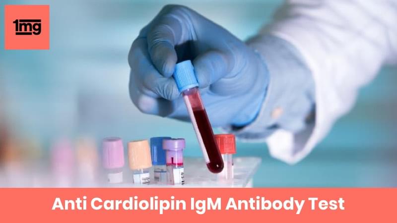 Anti Cardiolipin IgM Antibody
