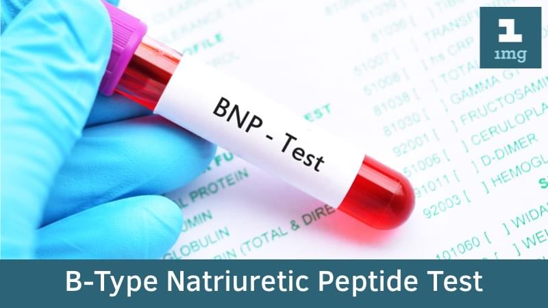 BNP : Purpose & Normal Range Of Results | 1mg