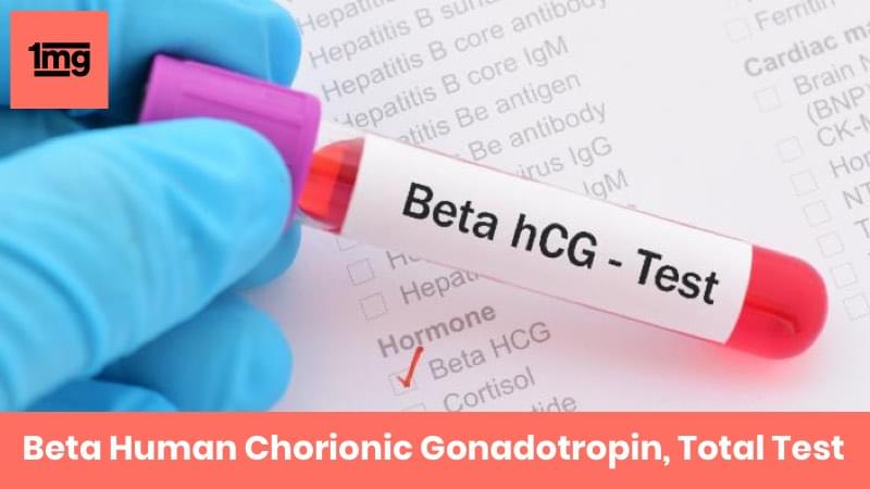 Beta Human Chorionic Gonadotropin, Total Test