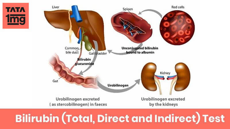 Bilirubin Total Direct And Indirect Purpose Normal Range Of Results 1mg