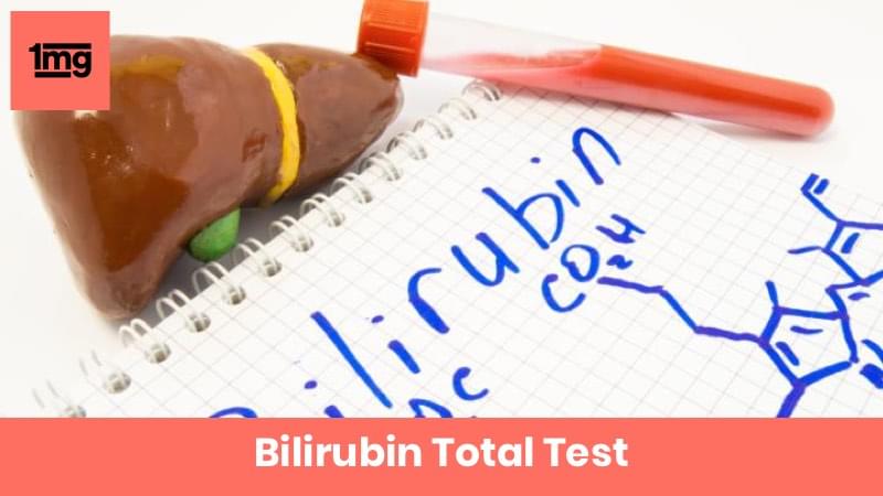 Bilirubin Total