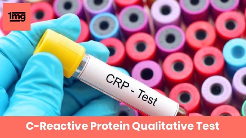 C-Reactive Protein Qualitative