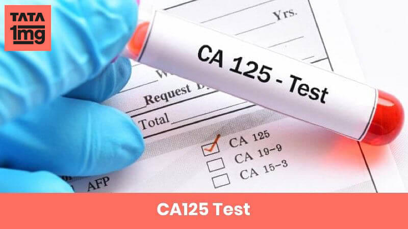 CA125