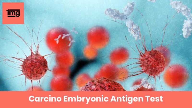 Carcino Embryonic Antigen