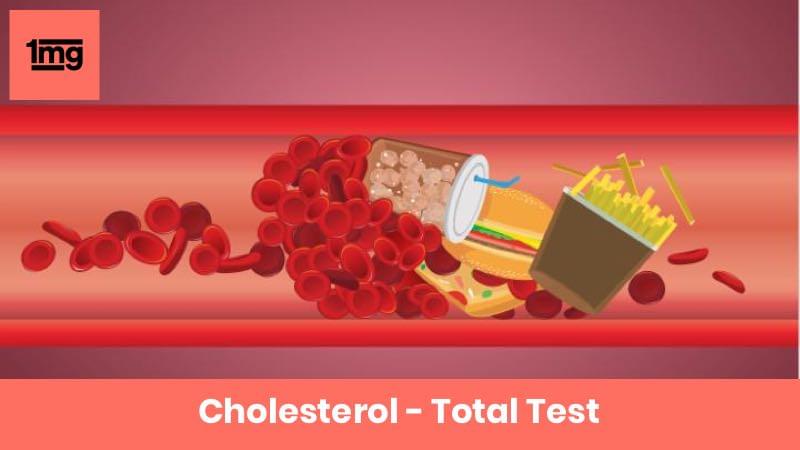 Cholesterol - Total