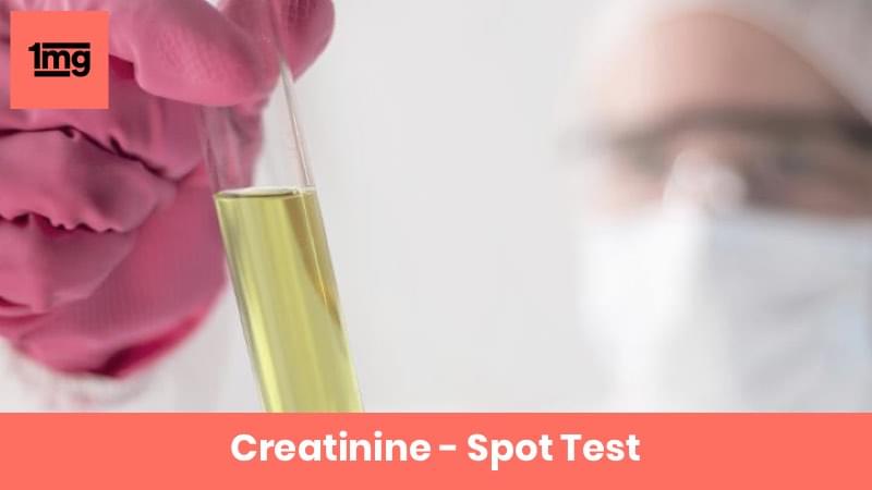 Creatinine - Spot