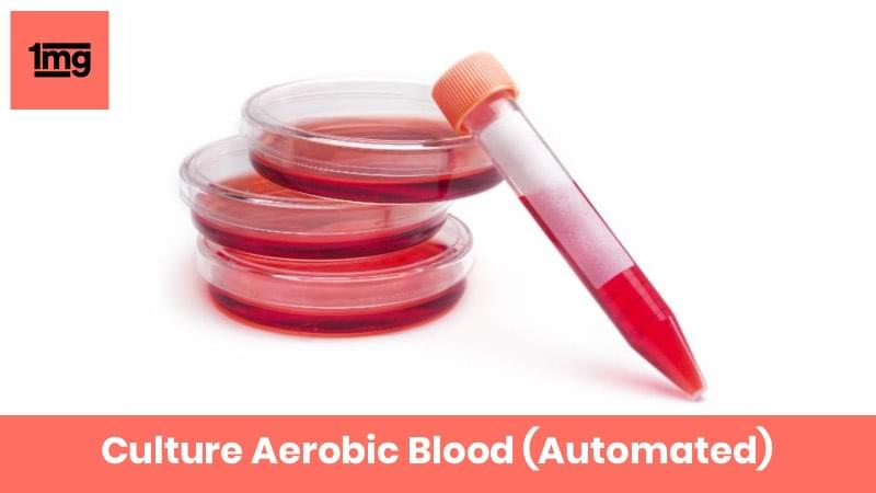 Culture Aerobic Blood (Automated)