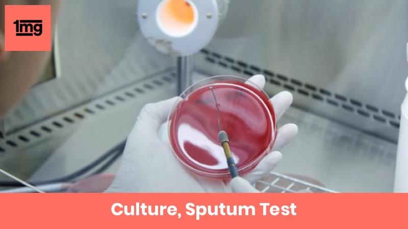 culture-sputum-purpose-normal-range-of-results-1mg