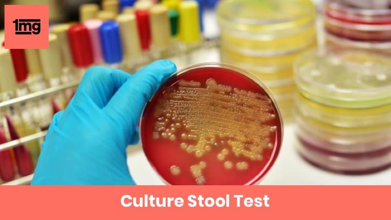 Culture Stool : Purpose & Normal Range of Results | 1mg