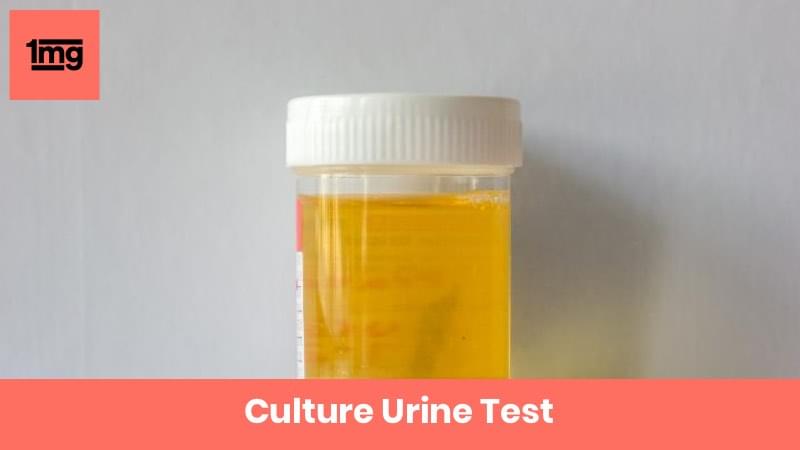 Culture Urine