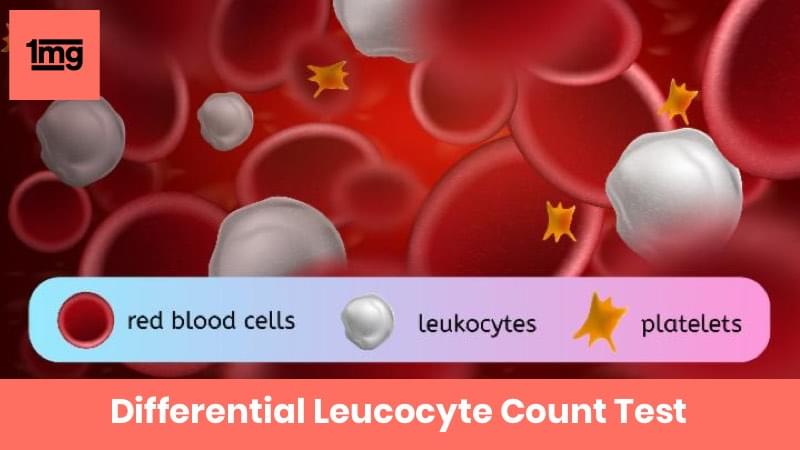 Differential leucocyte Count