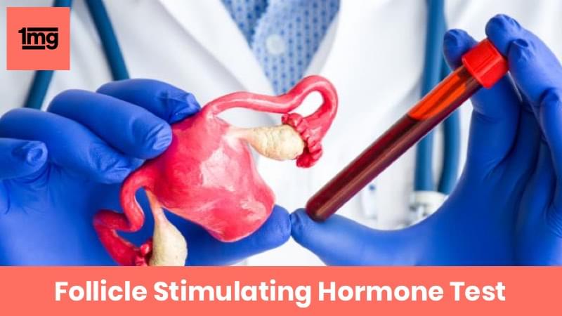 Follicle Stimulating Hormone