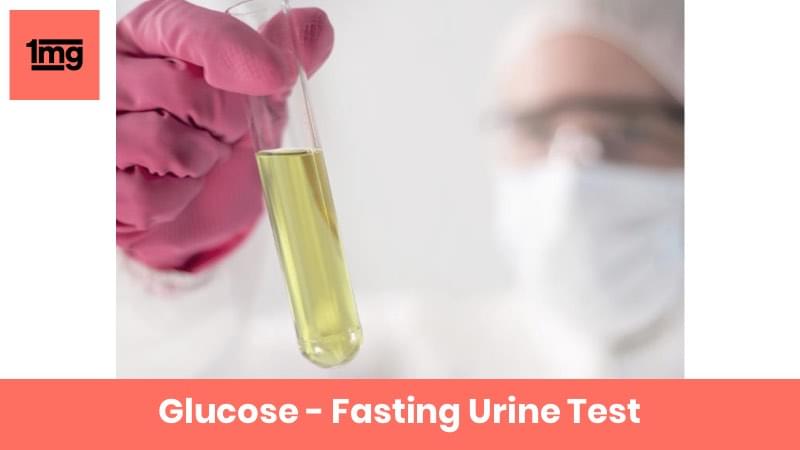 Glucose - Fasting Urine