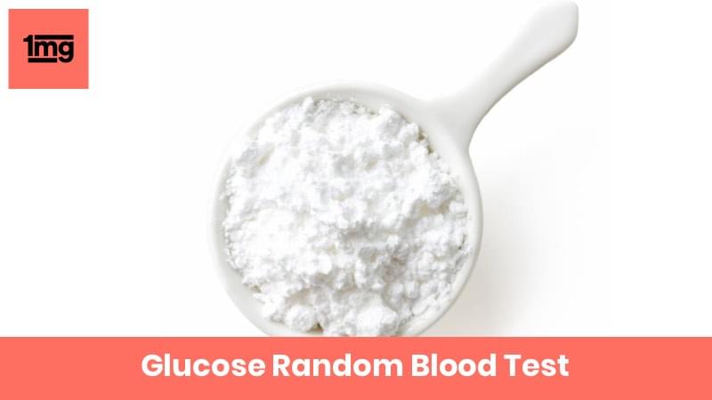 Glucose - Random Blood