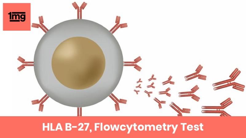 HLA B-27, Flowcytometry In New Delhi From R V Metropolis Diagnostic And ...