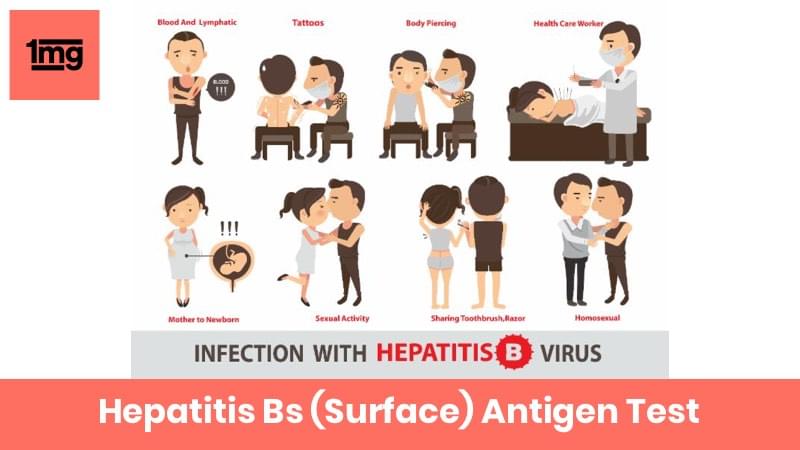 Hepatitis Bs (Surface) Antigen