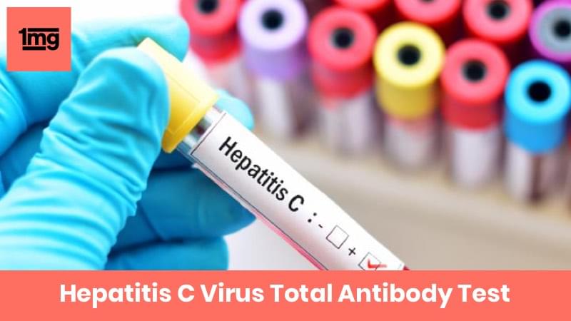 Hepatitis C Virus Total Antibody