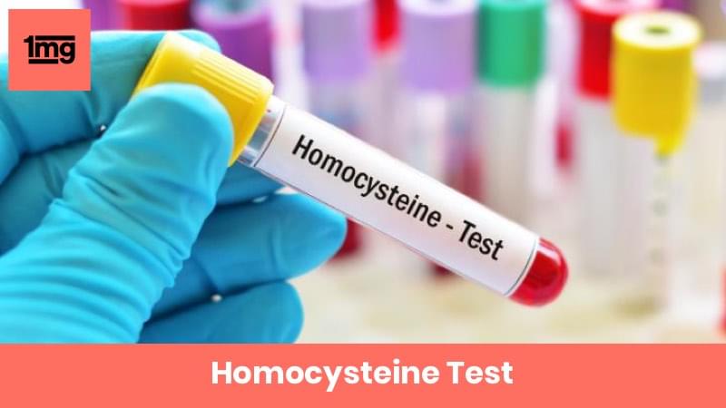 Homocysteine