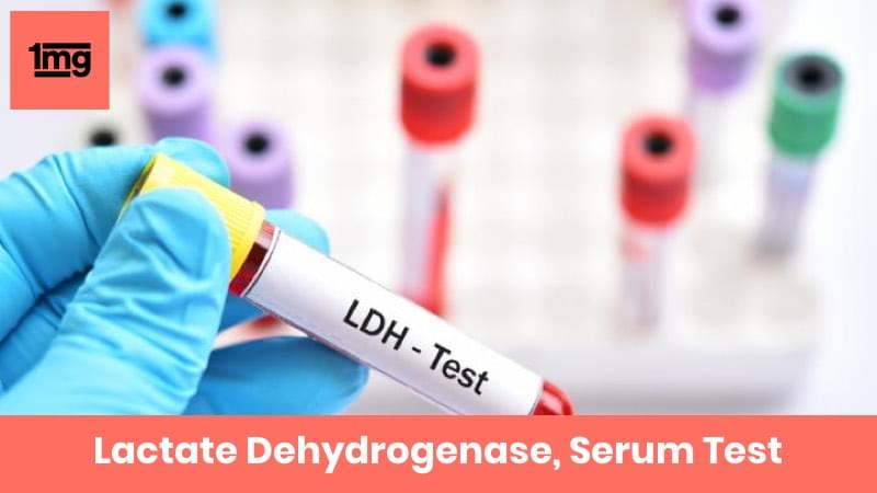 Lactate Dehyderogenase, Serum