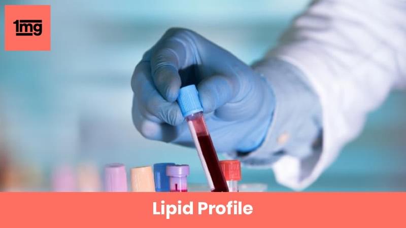 Lipid Profile