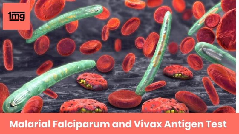 Malarial Falciparum and Vivax Antigen