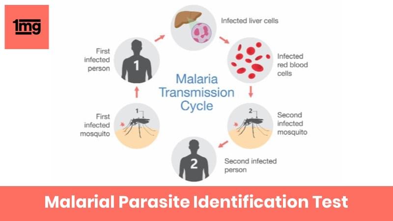 Malarial Parasite Identification