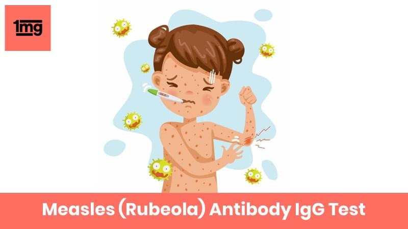 Measles (Rubeola) Antibody IgG