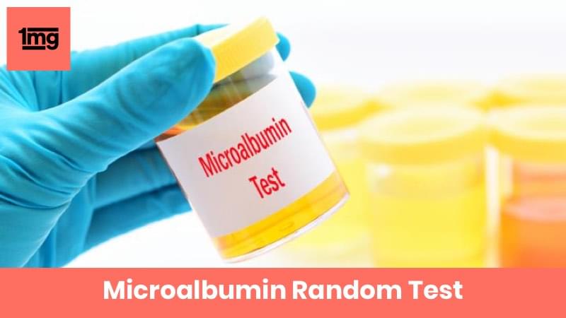 Microalbumin Random