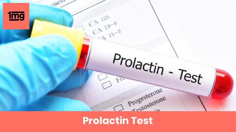 Prolactin Test