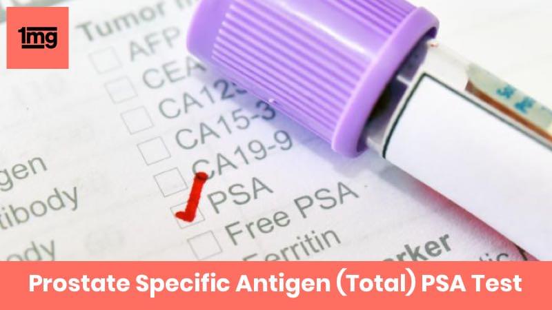 Prostate Specific Antigen (Total) PSA